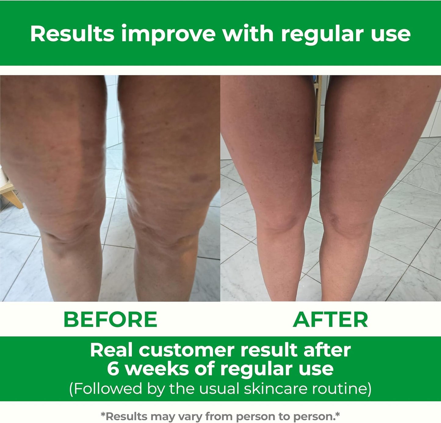 Cellufree - Cellulite Massager