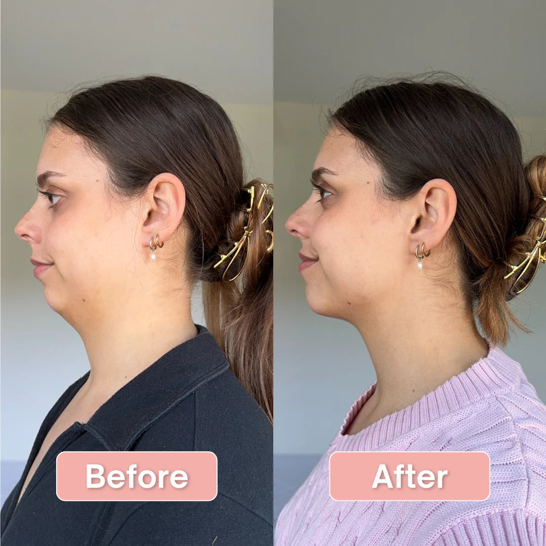Dazara V-Line Face Strap